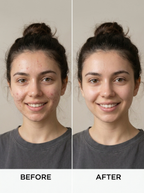Gel Cleanser for Acne-Prone Skin
